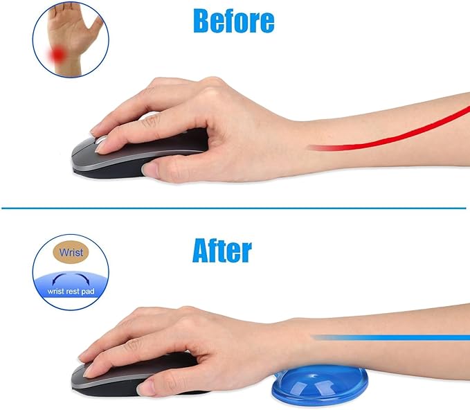Gel Keyboard & Mouse Wrist Rest Set - Keyboard Wrist Rest Pad & Mouse Support for Office Gaming Pad Computer Laptop Ergonomic Comfortable Pain Relief- Pad Set (Mouse Support Only)
