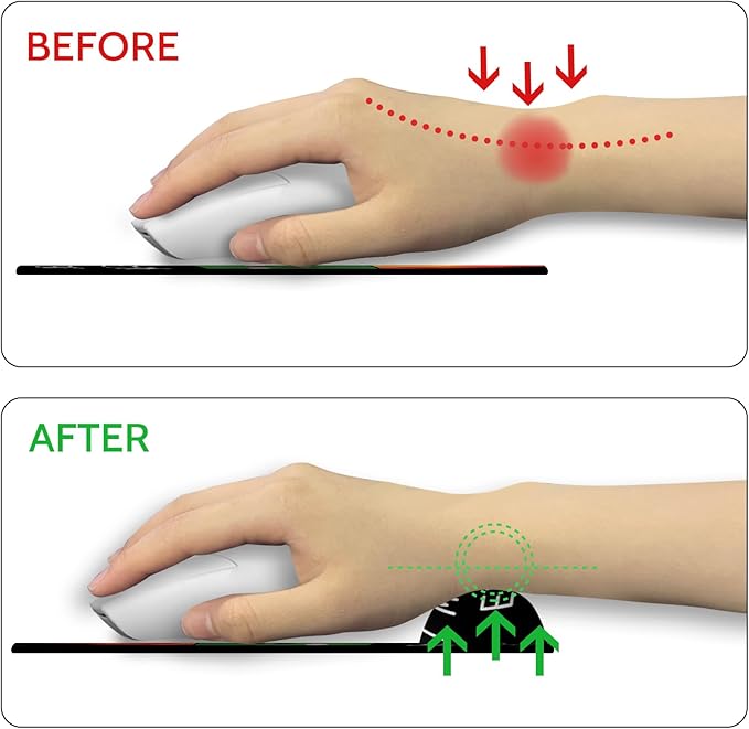 Ergonomic Mouse Pad with Wrist Support, Dumpster on Fire Mouse Pad with Wrist Rest, Gaming Mousepad with Non-Slip Pain Relief PU Base, Cute Mouse Pad for Desk Accessories Office Supplies Decor
