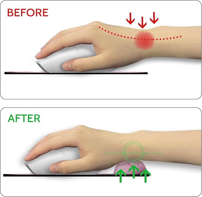 Mouse Pad with Wrist Rest, Pufferfish Ergonomic Mousepad Wrist Support for Desk, Cute Animial Gaming Mousepads for Wireless Mouse Funny Computer Work Home Desk Accessories Office Supplies Decor