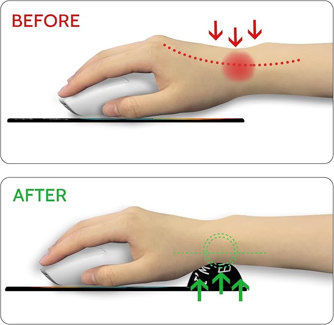 Ergonomic Mouse Pad with Wrist Support, Dumpster on Fire Mouse Pad with Wrist Rest, Gaming Mousepad with Non-Slip Pain Relief PU Base, Cute Mouse Pad for Desk Accessories Office Supplies Decor