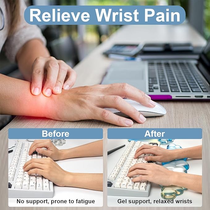 Keyboard Wrist Rest with Cloud Mouse Pad - Gradient Blue Ergonomic Gel Cloud Mouse Pad with Non-Slip Base, Cute Office Accessories for Desktop/Latop/Home/Office
