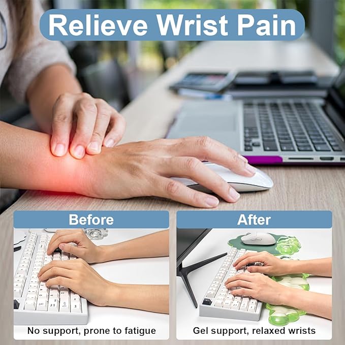 Cloud Wrist Rest and Cloud Mouse Pad for Keyboard and Mouse - Ergonomic Cloud Mouse Pad with Gel Wrist Support, Non-Slip Base Cute Office Accessories for/Desktop/Latop/Home/Gaming